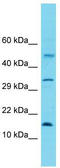 Mitochondrial Ribosomal Protein L30 antibody, TA337437, Origene, Western Blot image 