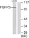 Fibroblast Growth Factor Receptor 3 antibody, LS-C118448, Lifespan Biosciences, Western Blot image 