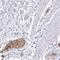 Erythrocyte Membrane Protein Band 4.2 antibody, PA5-59127, Invitrogen Antibodies, Immunohistochemistry paraffin image 