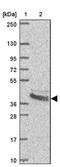 Branched Chain Amino Acid Transaminase 2 antibody, NBP2-33705, Novus Biologicals, Western Blot image 