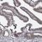 Proteasome 20S beta2 subunit antibody, NBP1-92295, Novus Biologicals, Immunohistochemistry paraffin image 
