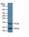 Hepatic lipase antibody, LS-C295162, Lifespan Biosciences, Western Blot image 