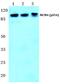 DNA replication licensing factor MCM4 antibody, PA5-36859, Invitrogen Antibodies, Western Blot image 