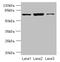 Coiled-Coil Domain Containing 116 antibody, CSB-PA812904LA01HU, Cusabio, Western Blot image 