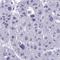 Zinc Finger Protein 684 antibody, NBP2-31751, Novus Biologicals, Immunohistochemistry frozen image 