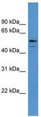 AMPS antibody, TA342801, Origene, Western Blot image 