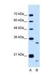 Cell Cycle Progression 1 antibody, NBP1-70758, Novus Biologicals, Western Blot image 