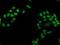Phosphoglycerate Mutase 2 antibody, MA5-25670, Invitrogen Antibodies, Immunocytochemistry image 