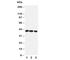 C-C Motif Chemokine Receptor 4 antibody, R30591, NSJ Bioreagents, Western Blot image 
