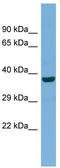 Mitofusin 1 antibody, TA344645, Origene, Western Blot image 