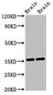 Nitrilase 1 antibody, CSB-PA768228LA01HU, Cusabio, Western Blot image 