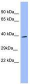 SH3 Domain Containing GRB2 Like 2, Endophilin A1 antibody, TA342207, Origene, Western Blot image 