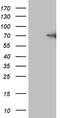 Coagulation Factor XII antibody, M01226-1, Boster Biological Technology, Western Blot image 