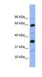 ATIII antibody, NBP1-57918, Novus Biologicals, Western Blot image 