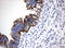 Cancer/Testis Antigen 1B antibody, LS-C796745, Lifespan Biosciences, Immunohistochemistry paraffin image 