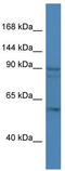 ERCC Excision Repair 6, Chromatin Remodeling Factor antibody, TA335163, Origene, Western Blot image 