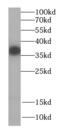 Coproporphyrinogen Oxidase antibody, FNab01869, FineTest, Western Blot image 