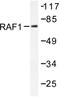 Raf-1 Proto-Oncogene, Serine/Threonine Kinase antibody, AP06438PU-N, Origene, Western Blot image 