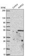 Prolyl-TRNA Synthetase 2, Mitochondrial antibody, NBP1-84105, Novus Biologicals, Western Blot image 