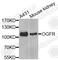 Opioid growth factor receptor antibody, A7074, ABclonal Technology, Western Blot image 