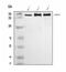 hUpf2 antibody, A03627-2, Boster Biological Technology, Western Blot image 
