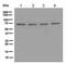 hPot1 antibody, ab124784, Abcam, Western Blot image 