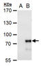 Methyl-CpG Binding Domain 4, DNA Glycosylase antibody, GTX129605, GeneTex, Western Blot image 