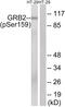 GRB2 Associated Binding Protein 2 antibody, 79-882, ProSci, Western Blot image 