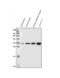 VAMP Associated Protein B And C antibody, A01372, Boster Biological Technology, Western Blot image 