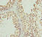 Piwi Like RNA-Mediated Gene Silencing 1 antibody, LS-C676269, Lifespan Biosciences, Immunohistochemistry paraffin image 
