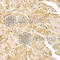 Actinin Alpha 1 antibody, A1160, ABclonal Technology, Immunohistochemistry paraffin image 