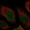 Nudix Hydrolase 13 antibody, NBP1-92207, Novus Biologicals, Immunocytochemistry image 