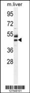 Cytosolic Thiouridylase Subunit 1 antibody, 55-136, ProSci, Western Blot image 