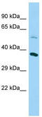 NADH:Ubiquinone Oxidoreductase Complex Assembly Factor 5 antibody, TA333684, Origene, Western Blot image 