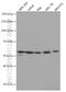 Autophagy protein 5 antibody, 66744-1-Ig, Proteintech Group, Western Blot image 