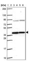 PIH1 domain-containing protein 1 antibody, NBP1-92269, Novus Biologicals, Western Blot image 