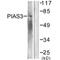 Protein Inhibitor Of Activated STAT 3 antibody, A02807, Boster Biological Technology, Western Blot image 