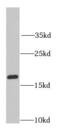 40S ribosomal protein S10 antibody, FNab07457, FineTest, Western Blot image 