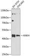 Progressive ankylosis protein homolog antibody, GTX64821, GeneTex, Western Blot image 