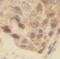 Ubiquitin Conjugating Enzyme E2 N antibody, FNab09154, FineTest, Immunohistochemistry frozen image 