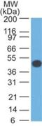 Keratin 18 antibody, NBP2-33176, Novus Biologicals, Western Blot image 
