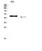 E2F Transcription Factor 3 antibody, STJ97801, St John