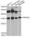 Protein Kinase AMP-Activated Non-Catalytic Subunit Beta 2 antibody, LS-C748394, Lifespan Biosciences, Western Blot image 