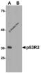 Ribonucleotide Reductase Regulatory TP53 Inducible Subunit M2B antibody, 2383, ProSci, Western Blot image 
