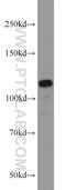 Protein Phosphatase 1 Regulatory Subunit 15B antibody, 14634-1-AP, Proteintech Group, Western Blot image 