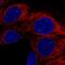 APC Membrane Recruitment Protein 3 antibody, PA5-62940, Invitrogen Antibodies, Immunofluorescence image 