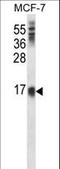 SCA-2 antibody, LS-C163930, Lifespan Biosciences, Western Blot image 