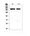 Myosin-7 antibody, MA1064, Boster Biological Technology, Immunohistochemistry paraffin image 
