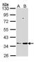 Prostaglandin E Synthase 2 antibody, TA308156, Origene, Western Blot image 