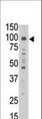 MAGE Family Member D1 antibody, LS-C100414, Lifespan Biosciences, Western Blot image 